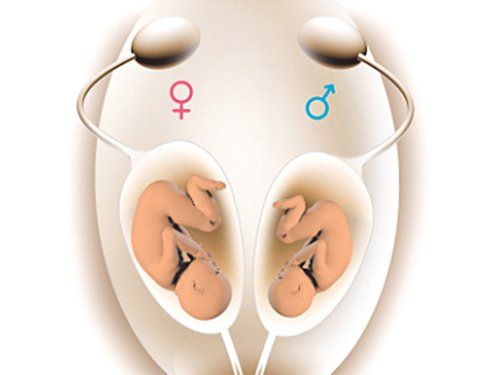 Giới tính thai nhi hình thành ngay khi trứng gặp tinh trùng